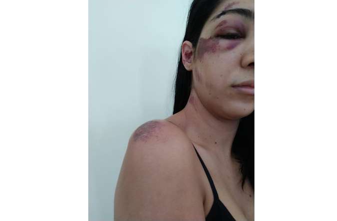 Advogada denuncia agressão de segurança em festa na Torre de TV Digital