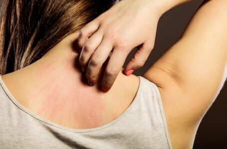 Como identificar e tratar a Alergia na pele