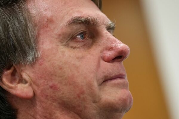 Bolsonaro tem piora da função renal e aumento de inflamação