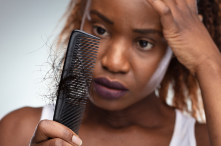 Queda de cabelo pós Covid: entenda o motivo e conheça os tratamentos