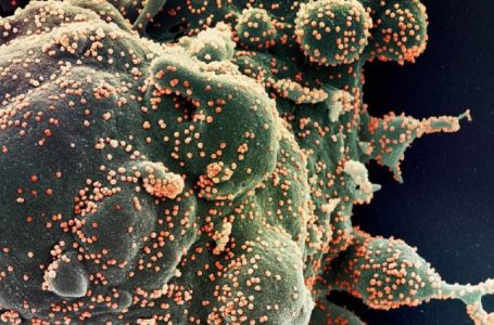 Covid: Anticorpos de infecção anterior não impedem ômicron, diz cientista