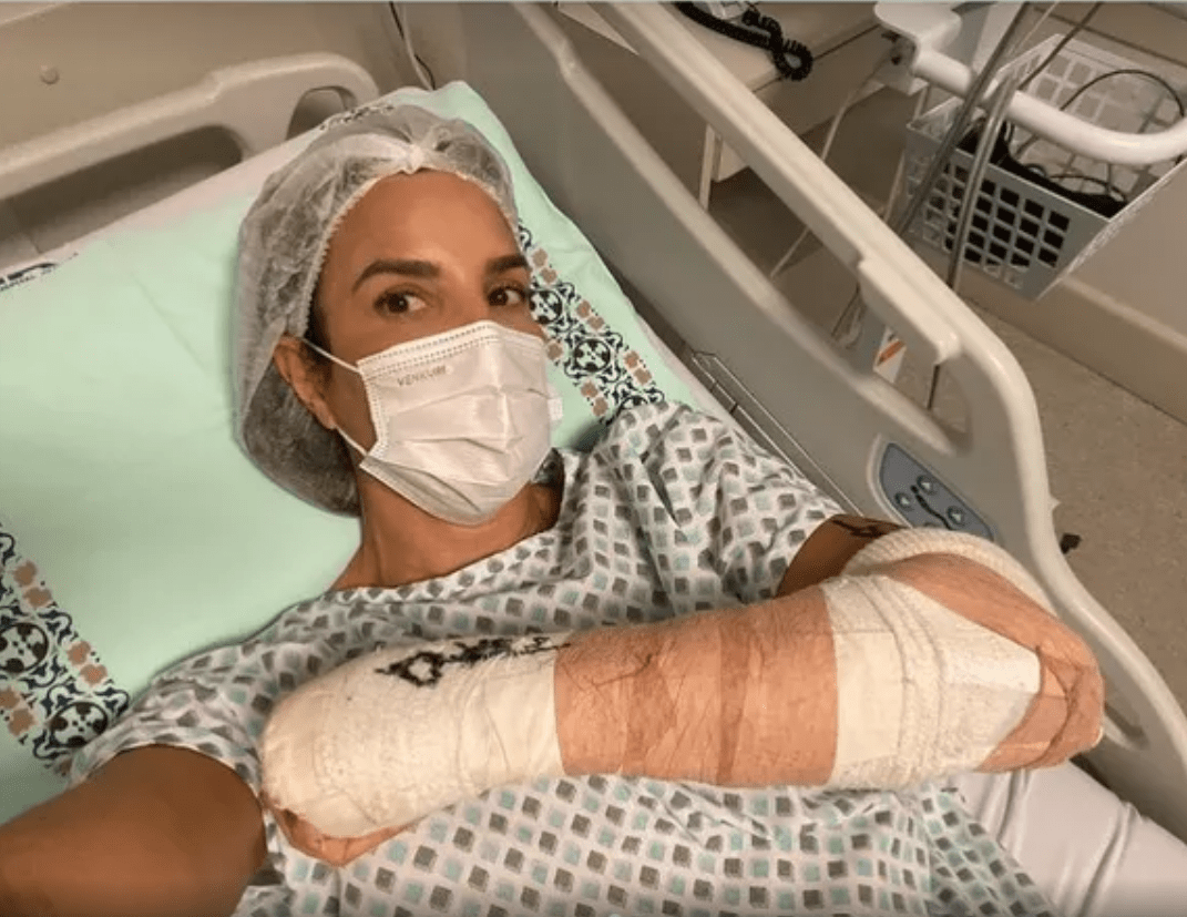 Ivete Sangalo passa por cirurgia no braço esquerdo e agradece equipe médica pelo sucesso na operação: ‘Mainha tá zero bala ❣️’