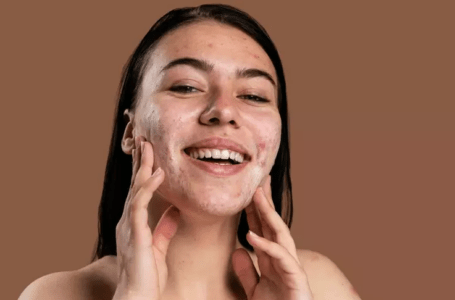 7 produtos para combater a acne e controlar a oleosidade da pele