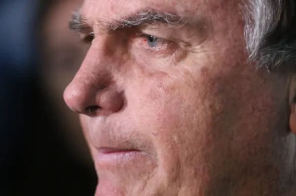 Com crise persistente de soluços, Bolsonaro faz nova cirurgia