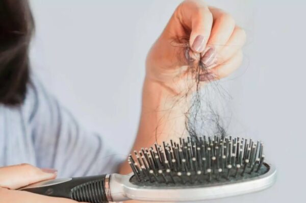 Alopecia: 5 sinais de alerta de que sua queda de cabelo é séria