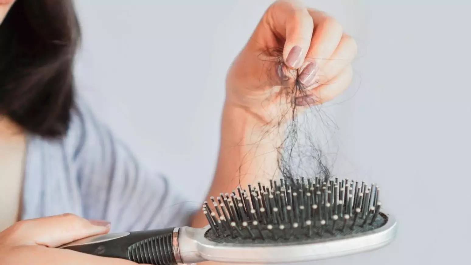 Alopecia: 5 sinais de alerta de que sua queda de cabelo é séria